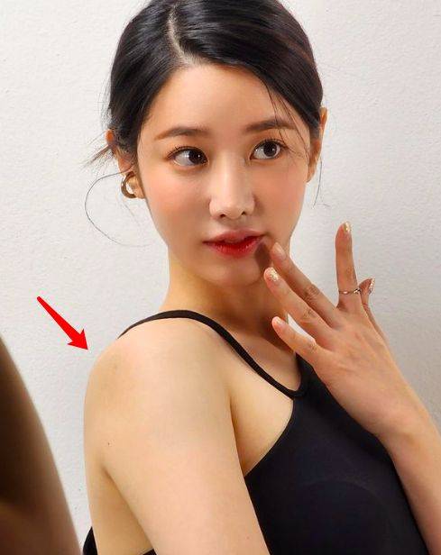 韩国女团Berry Good前成员祚弦五官更加精致 近照肩膀一片淤青引争议 (图5) 韩国女团Berry Good前成员祚弦五官更加精致 近照肩膀一片淤青引争议 (图5)