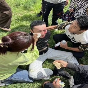 尼格买提录制节目遇意外面部受伤 半张脸都肿了起来